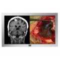 巴可42英寸医用监视器MDSC-2242