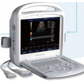 全数字彩色多普勒超声诊断仪X3 厂家低价直销
